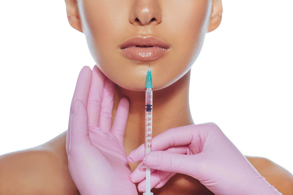 Close-up of natural-looking lip filler results with subtle volume enhancement at MiraMed and Day Spa in Santa Barbara