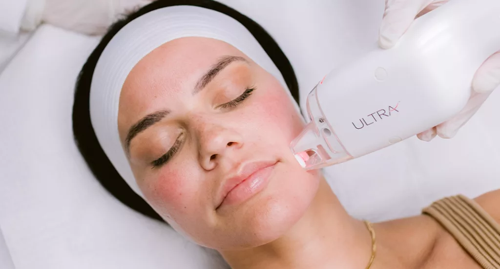 Young woman receiving Ultra Laser skin rejuvenation treatment at MiraMed and Day Spa in Santa Barbara