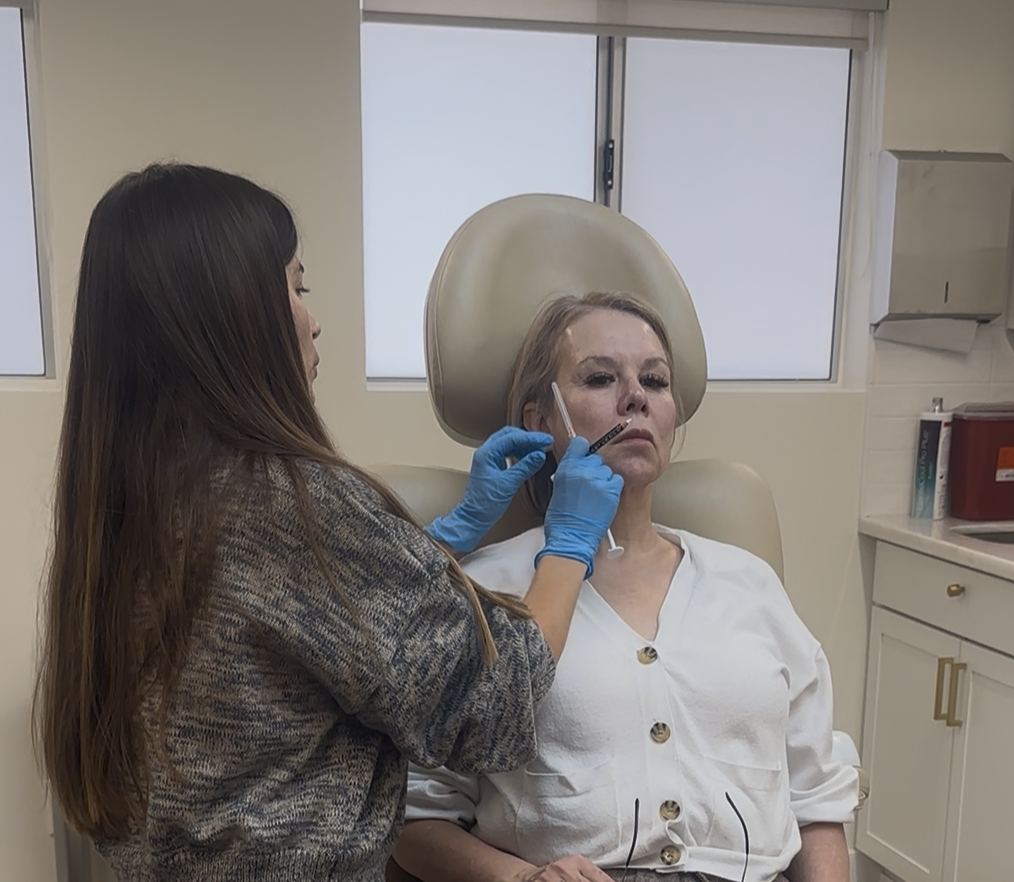 Woman receiving Hyperdilute Radiesse facial injection by licensed provider at MiraMed and Day Spa in Santa Barbara, California.