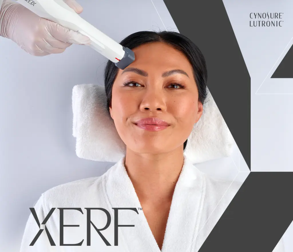 XERF skin tightening treatment in Santa Barbara at MiraMed and Day Spa